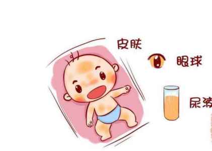 宝宝起名